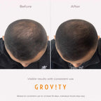 HAIR GRO SERUM