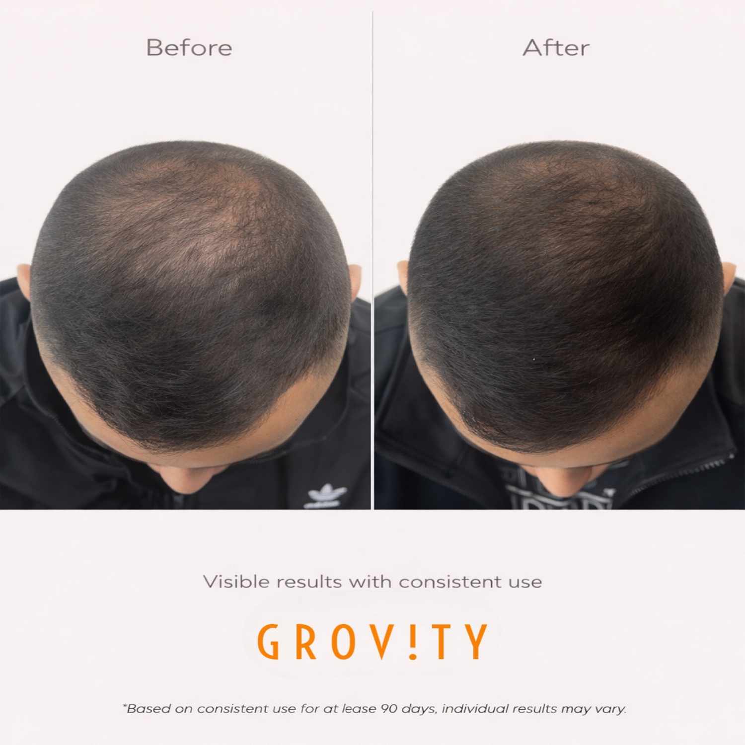 HAIR GRO SERUM